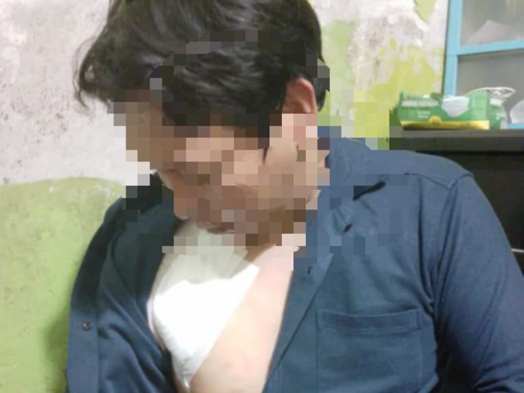 Pemotor di Ciomas Dibacok Begal, Polisi Buru Pelaku